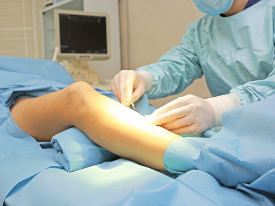 Ακρωτηριασμοί άκρων