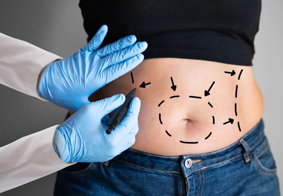 Παχυσαρκία